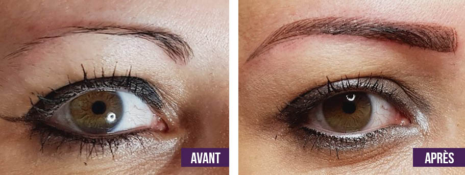 micropigmentation des sourcils